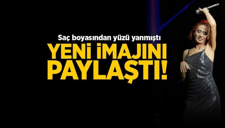 Yıldız Tilbe yeni imajını paylaştı! 'Yaralarım geçmeyecekti'