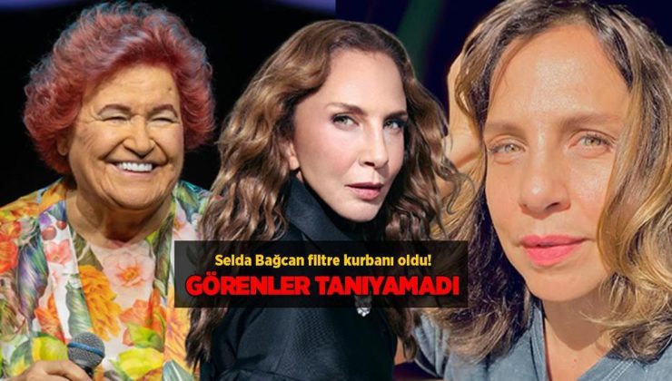 Selda Bağcan'ı görenler tanıyamadı! Filtre kurbanı oldu