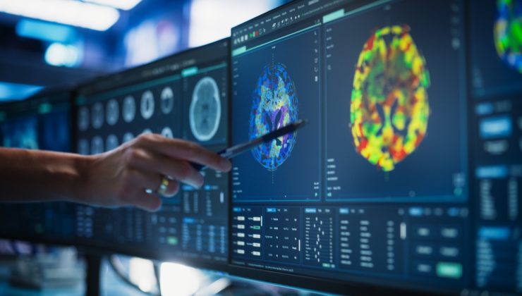 Alzheimer tedavisinde ‘lityum’ umudu