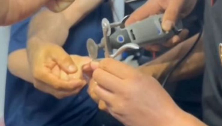 Kahramanmaraş’ta genç kızın parmağında yüzük sıkıştı