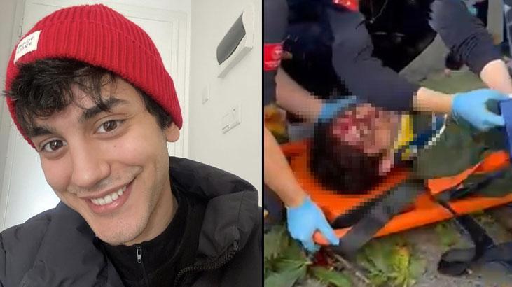 Oyuncu İbrahim Yıldız'ın üzerine ağaç devrildi! Hastaneye kaldırılan oyuncu ölüm kalım savaşı veriyor