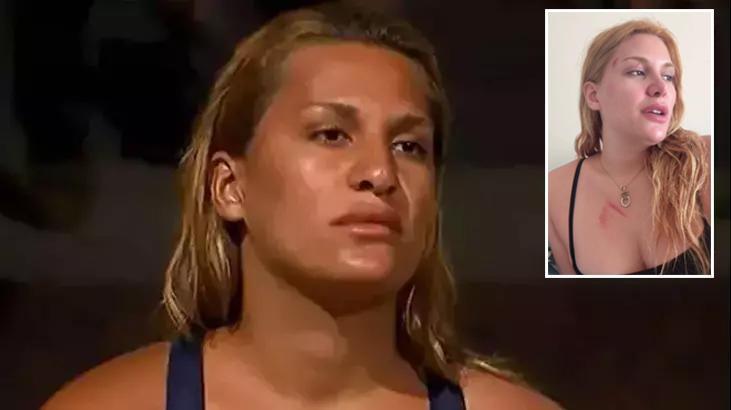 Survivor Almeda Baylan kaza geçirdi! O anları ve son durumunu anlattı: Ölümden döndük