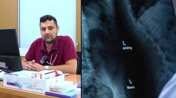 1,5 yıldır süren öksürük kâbusunun nedeni herkesi şaşırttı