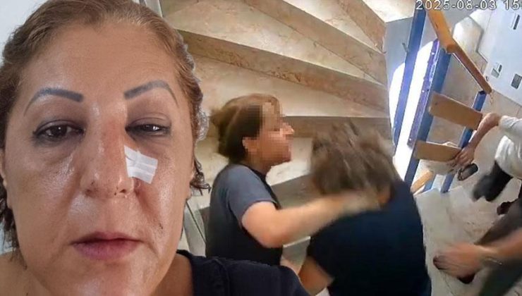 Ankara’da komşu kabusu! Kedileri beslediği için burnunu kırdılar: 'Bugün seni öldüreceğiz’