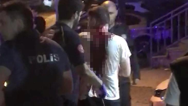 Avcılar’da kanlı pusu! 3 yıl önce kardeşi zıpkınlamıştı, bu kez sokakta kurşun yağmuruna tutuldu