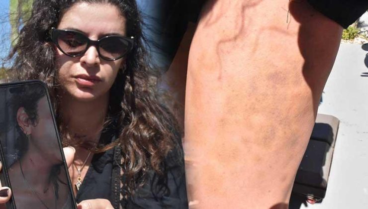 Eski erkek arkadaşı sokak ortasında dehşeti yaşadı! 'Günlerce yutkunamadım'