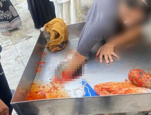 Genç kız salça makinesine elini kaptırmıştı!