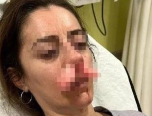 Otomobilin kapısı silah sayıldı!