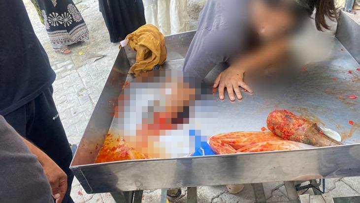 Şanlıurfa'da korkunç kaza! 16 yaşındaki genç kızın eli salça makinesine sıkıştı