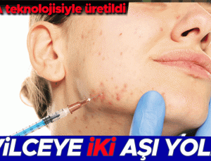 Sivilceye karşı iki aşı yolda