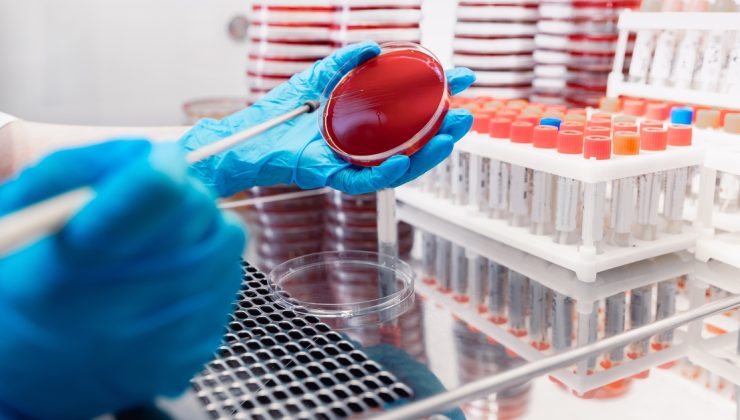 Yoğun bakımlarda direnç alarmı: Sepsise karşı silahlar tükeniyor