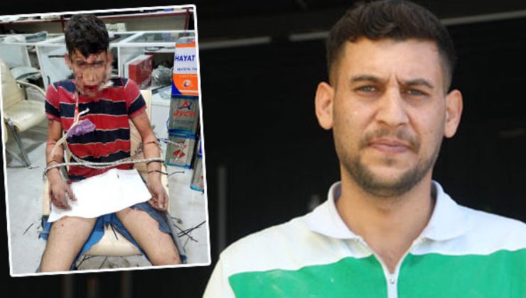 Böcek yedirip, dişlerini kırdılar! İşte vahşete istenen ceza!