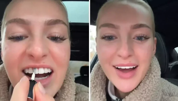 Dişlerini beyazlatmak için yaptığı akılalmaz!