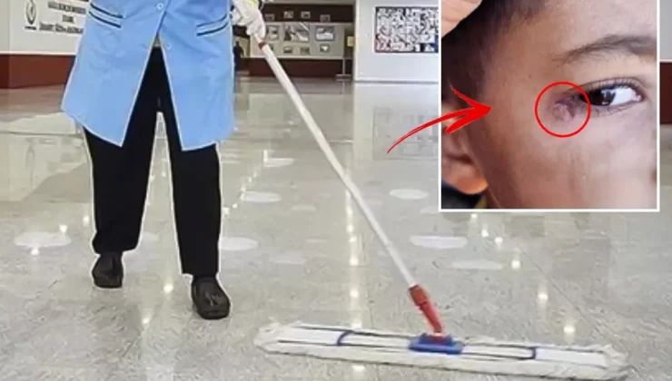İlkokulda dehşet! Temizlik görevlisi minik Mustafa’nın yüzünde sigara söndürdü