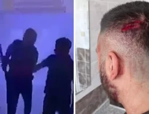 Öğretmene veliden sopalı saldırı