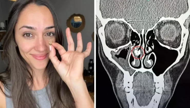 35 yıl sonra ortaya çıkan gerçek: Burnundan çıkan şeye kimse inanamadı