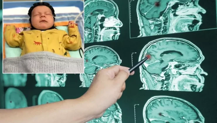 Çığır açacak adım! Beyin hasarı artık erken tespit edilebilecek