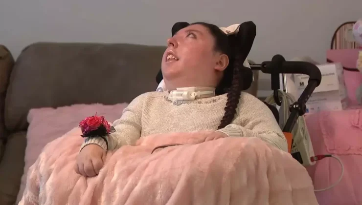 Doktorlar 5 yıl yaşamaz demişti, şimdi 20 yaşında