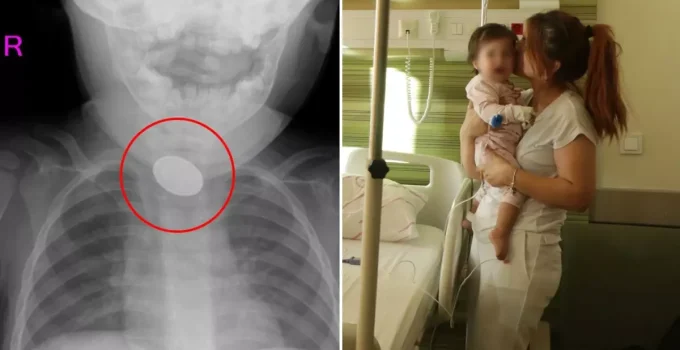 Kardeşi fark etti, hastaneye koştular! 15 aylık bebeğin yemek borusundan çıkanlar şoke etti