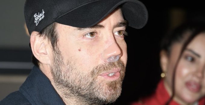 Murat Dalkılıç’tan burun ameliyat açıklaması