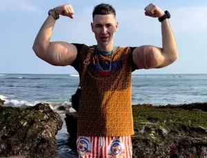 Rus Temel Reis’in kolları tehlikede: Tehlikeli enjeksiyonlar ağır enfeksiyona yol açtı