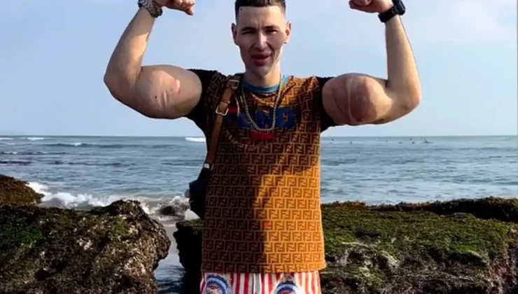 Rus Temel Reis’in kolları tehlikede: Tehlikeli enjeksiyonlar ağır enfeksiyona yol açtı