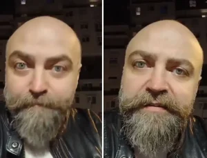 Saçsız adam isyan etti! Berbere ödediği ücret öyle böyle değil