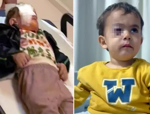 Torpil küçük çocuğun gözünü kör etti, babası kahreden gerçeği açıkladı