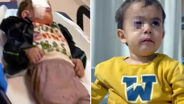 Torpil küçük çocuğun gözünü kör etti, babası kahreden gerçeği açıkladı