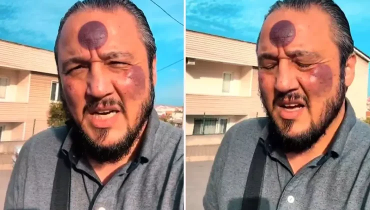 Yüzüne yaptırdığı işlemden sonra bu hale geldi, yine de savundu