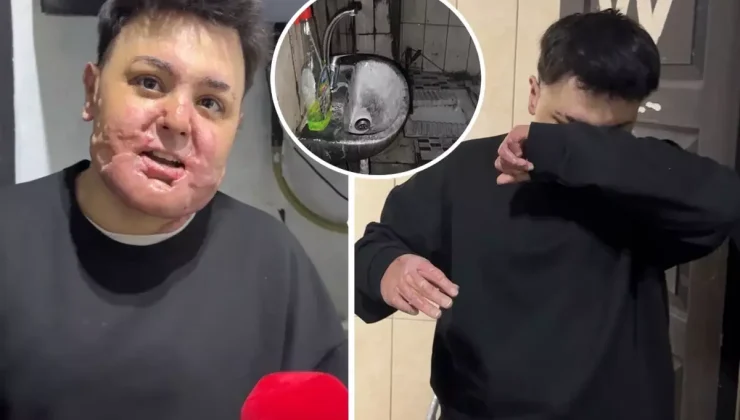 65 ameliyat geçirdi, 12 gün uyutuldu! Hayatı saniyeler içinde kabusa döndü