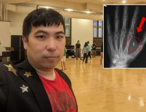 Akılalmaz hata! Eline yerleştirdiği mikroçipin şifresini unuttu