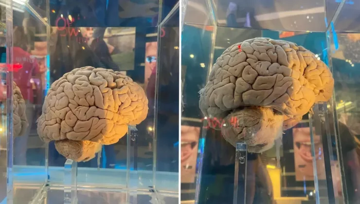 Amsterdam’daki dev arşiv: 5 bin 300 beyin yapay zeka ile haritalanacak