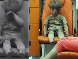 Bakın nerede ortaya çıktı: İşte dünya gündemine oturan Ümran bebeğin son hali