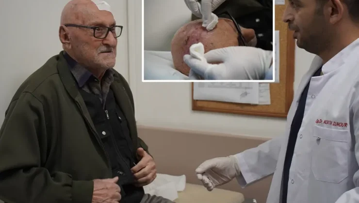 Dünyada iki örneği vardı, üçüncüsü Türkiye’de ortaya çıktı! Neredeyse ceviz büyüklüğünde