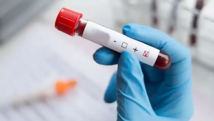 Dünyada vakalar azalıyor, Türkiye’de ise HIV artıyor