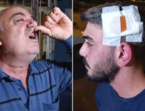 Komşu dehşeti! Babanın dişlerini kırdı, anneyle oğlunu bıçakladı