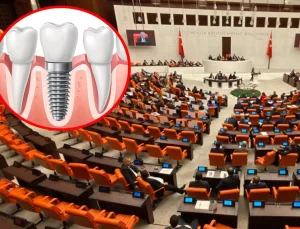 Milyonları ilgilendiren teklif Meclis’e sunuldu! İmplant tedavisi ücretsiz oluyor