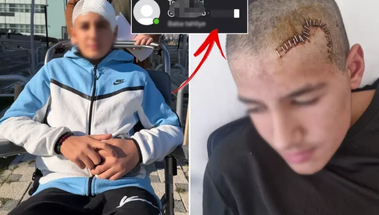 Okul arkadaşı taşla kafasını parçaladı! Tahliye edilen çocuğun paylaşımı çıldırttı