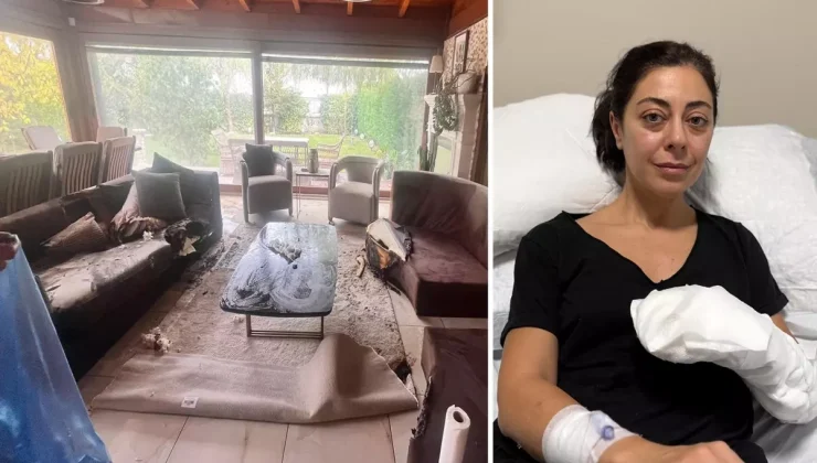 Sakın evinize sokmayın! Dekoratif olarak aldı, vücudunun yüzde 30’u yandı