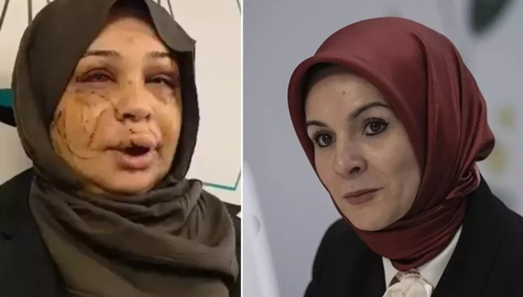 Bakan Göktaş: Şiddete uğrayan kardeşimizin yanındayız, davaya müdahil olacağız