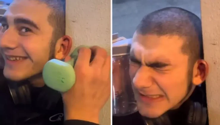 Dövüşçülere benzemek için kulak kıkırdaklarını kırdırdı