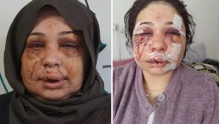 Polis eşi tarafından darbedildiği iddiasıyla şikayetçi oldu