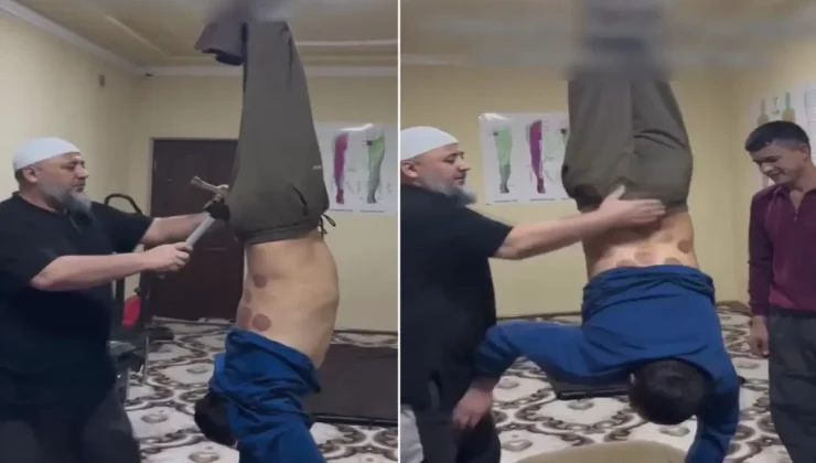 Tedavi değil işkence! Ayaklarından tavana asıp çekiç ve kazıkla…
